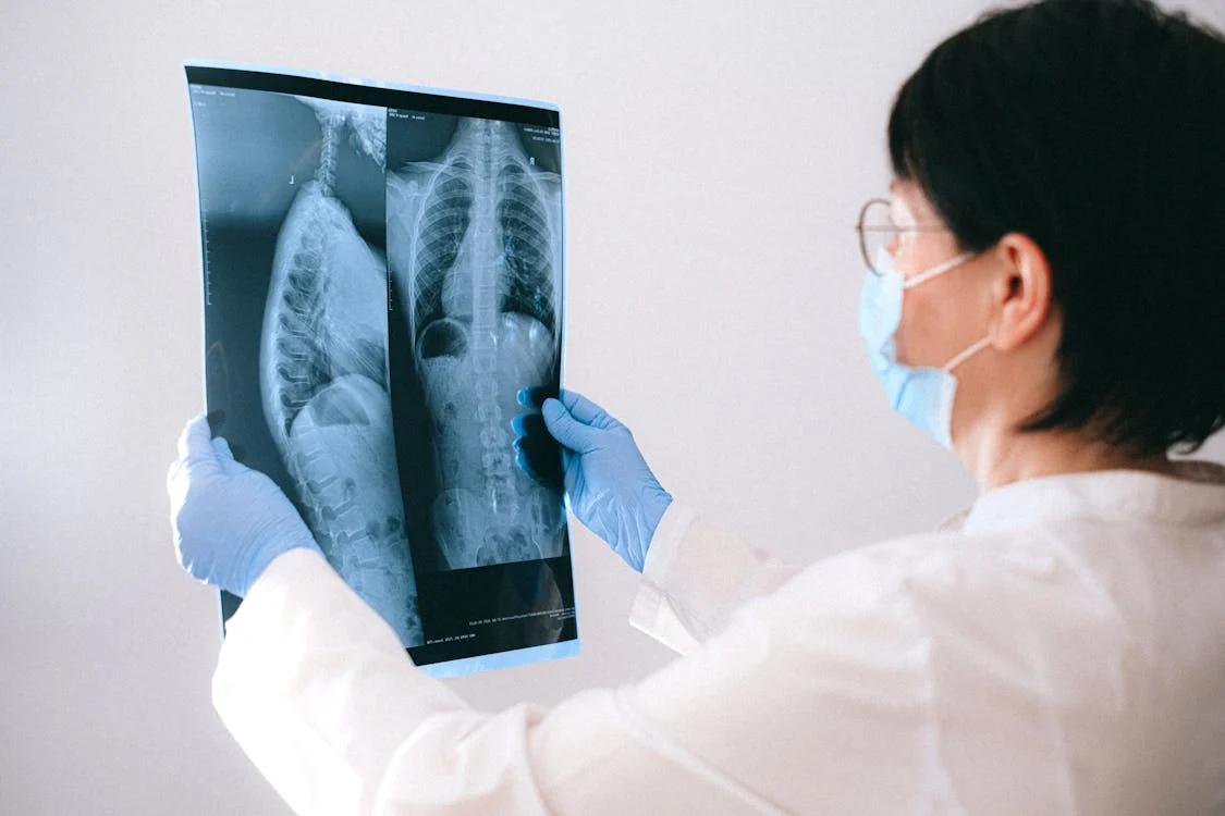 A healthcare professional wearing gloves and examining an X-ray image of the chest.