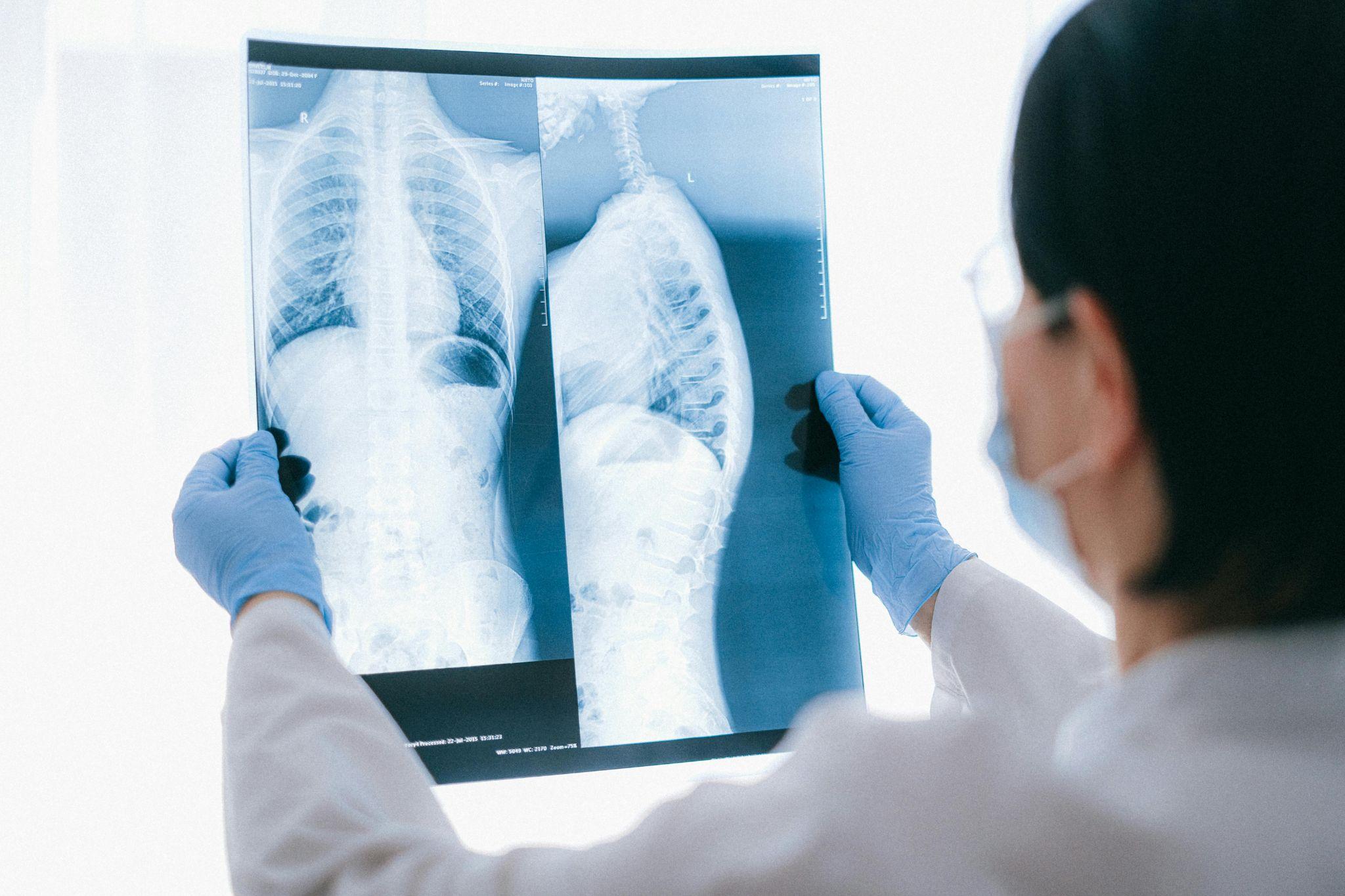 A doctor reviewing a patient's X-ray images