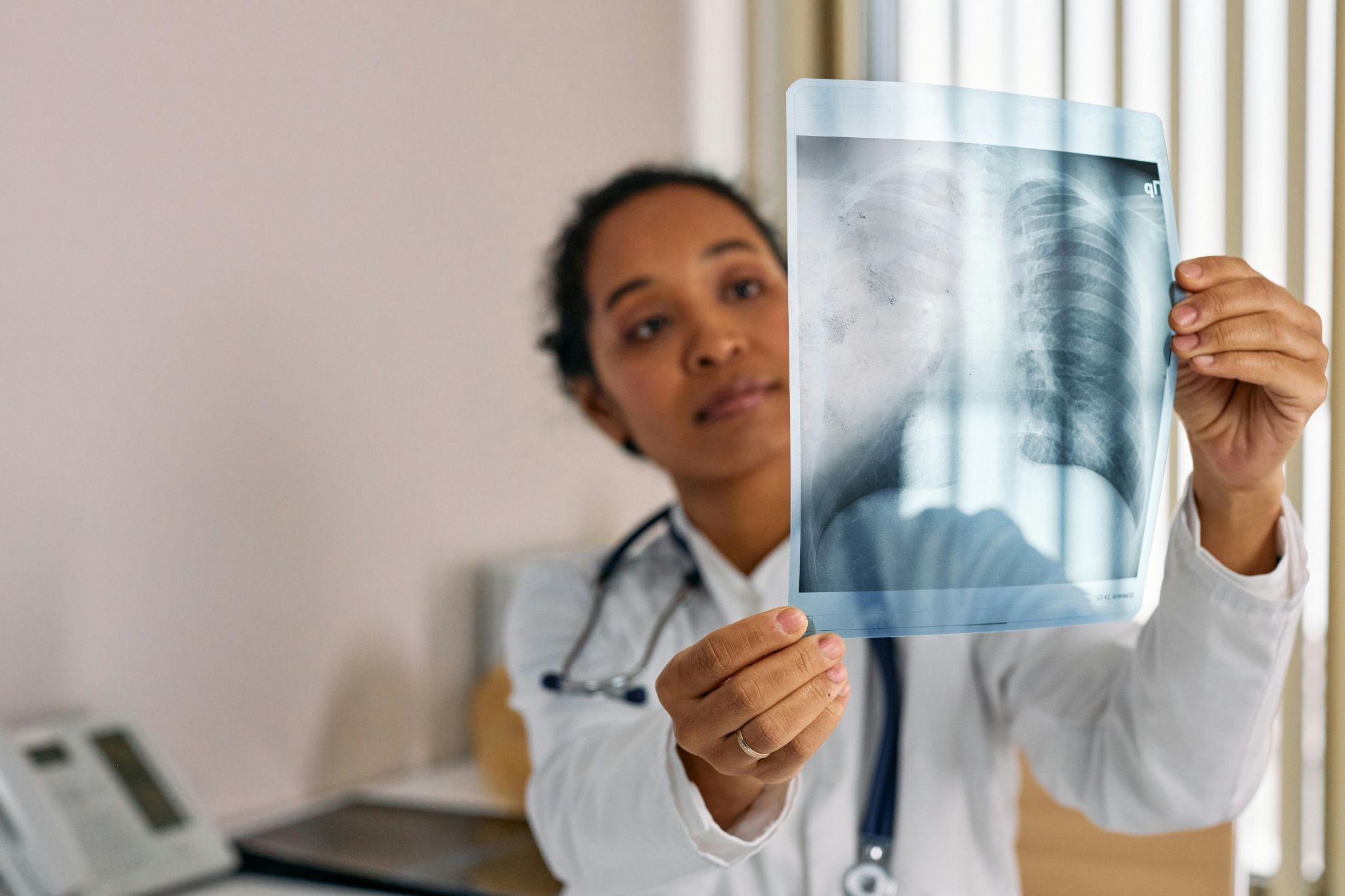 A doctor holding up an X-ray image, examining lung health