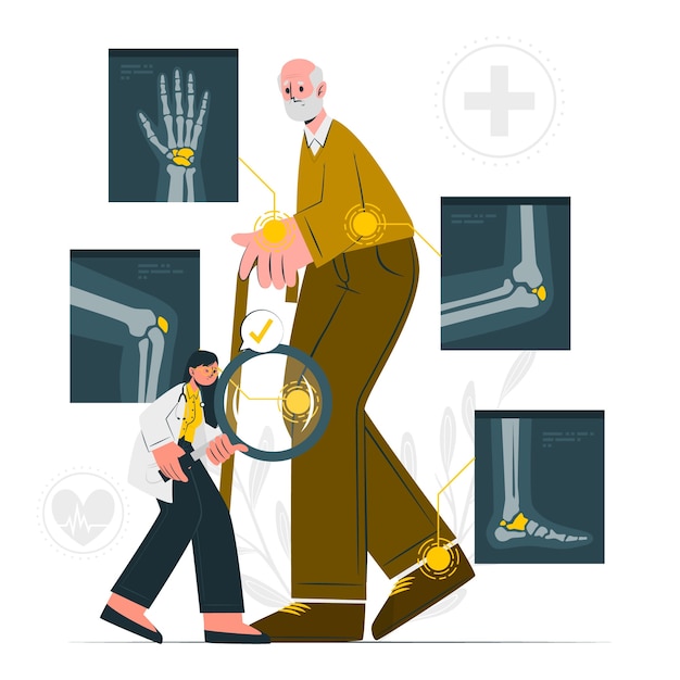Illustration of weak bones due to calcium deficiency
