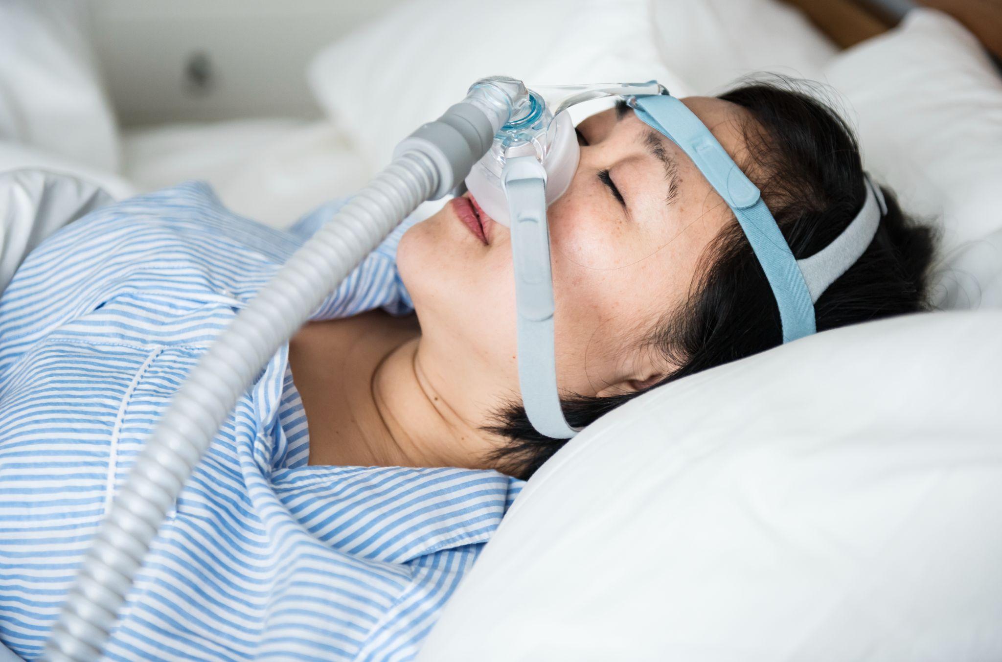 A woman wearing a CPAP mask while sleeping, used for treating sleep apnea