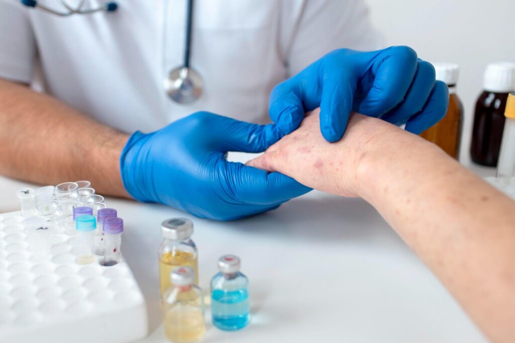 Doctor examining a patient’s hand for signs of a chronic wound
