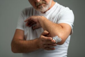 Man applying ointment to a minor wound on his elbow