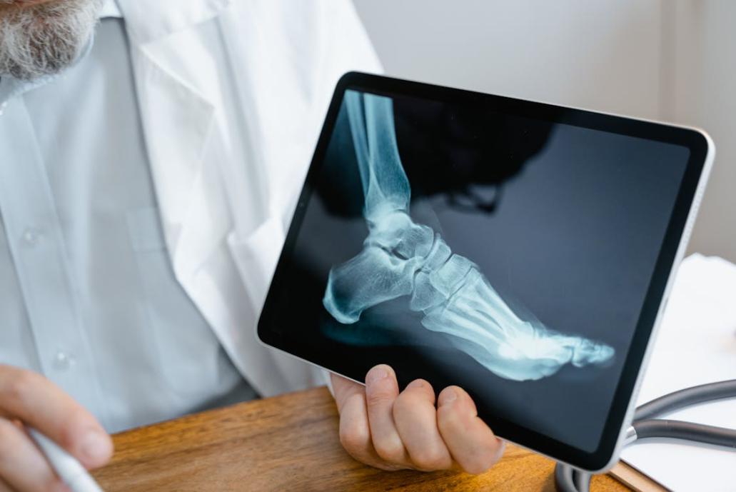 An image of a doctor holding up an ankle x-ray on a tablet