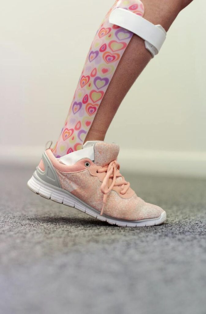 This photo shows a walking person wearing an ankle-foot orthosis device.