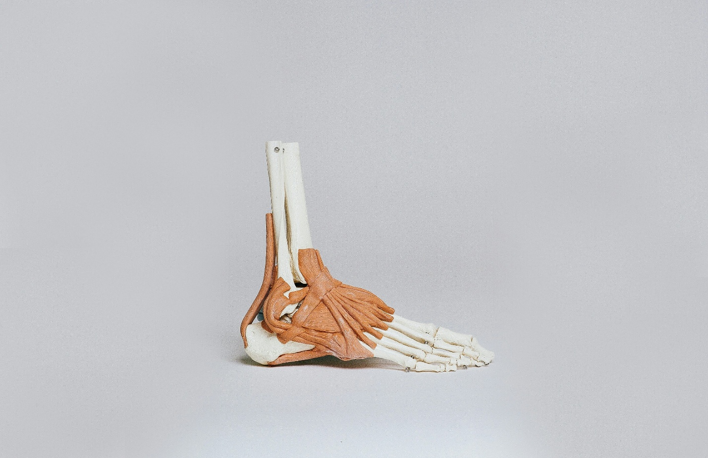 Anatomical model showing foot bones and ligaments